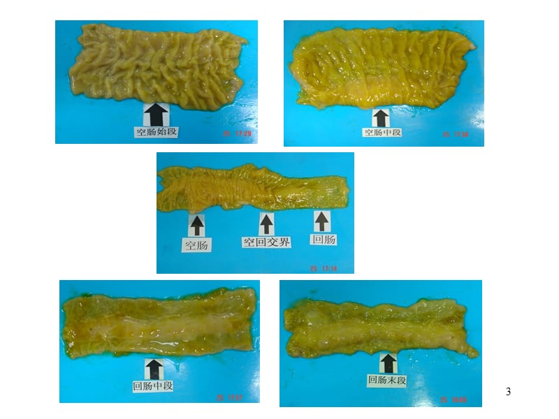 小肠疾病诊断流程ppt课件_第3页