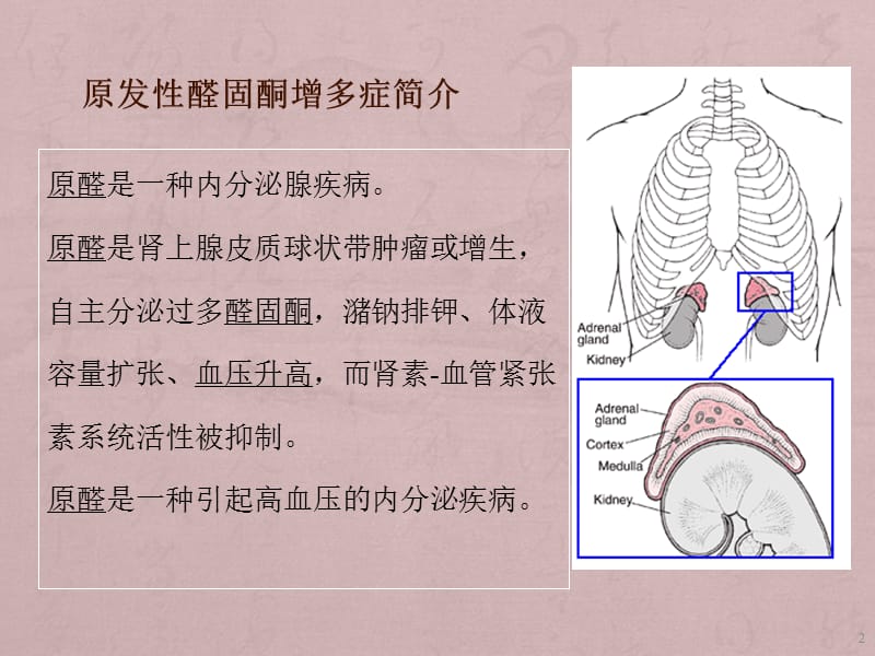 原发性醛固酮增多症ppt课件_第2页