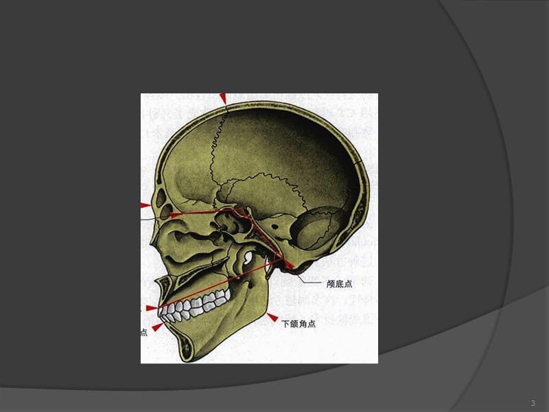 斜坡肿瘤ppt课件_第3页