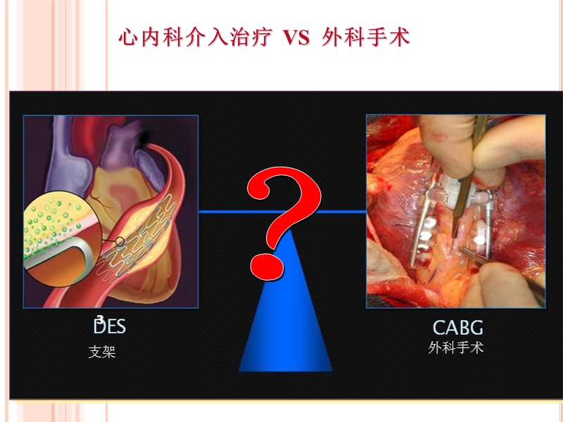 心血管病介入性诊治及护理ppt课件_第3页