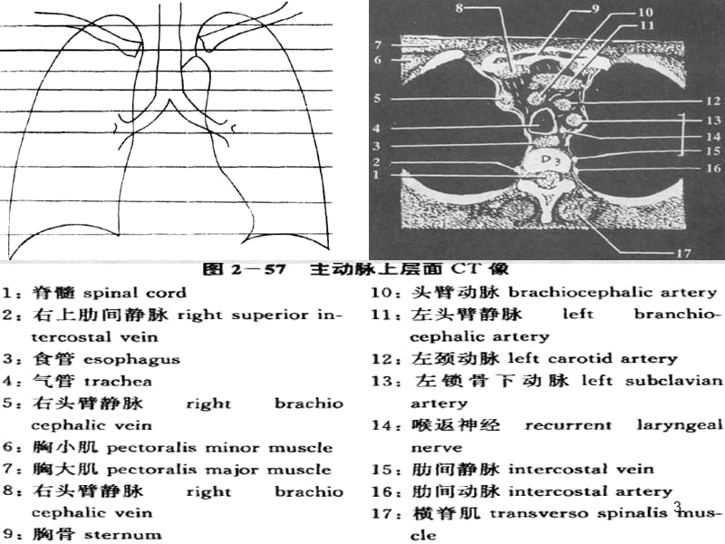 心血管系统CT读片手册ppt课件_第3页