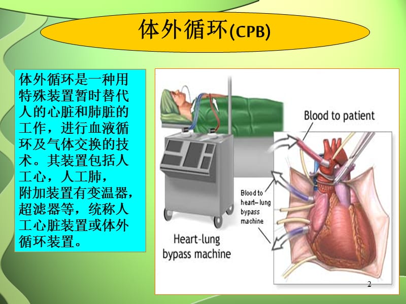 心脏外科术后监护ppt课件_第2页