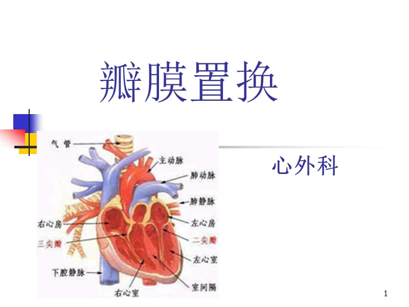 心脏瓣膜病个案ppt课件_第1页