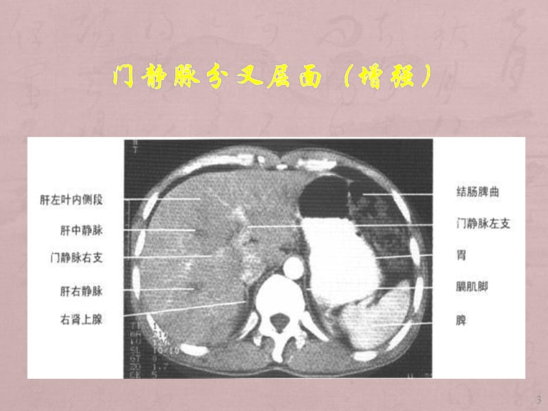 影像解剖学ppt课件_第3页