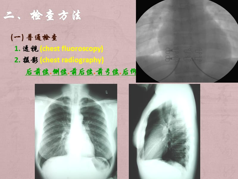 影像PPT_第1页