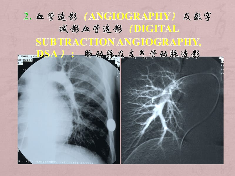 影像PPT_第2页