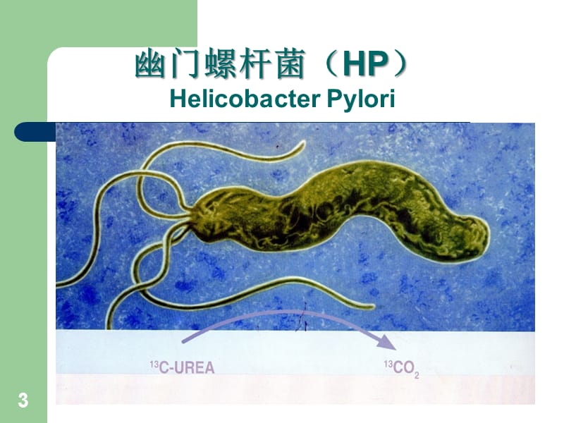 幽门螺杆菌共识解读PPT课件_第3页