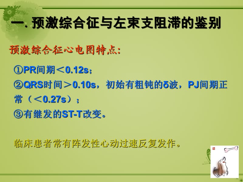 预激综合征合并左束支阻滞的心电图诊断 ppt课件_第3页