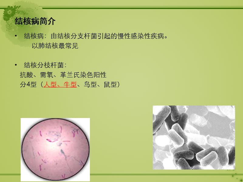 原发肺结核_第2页