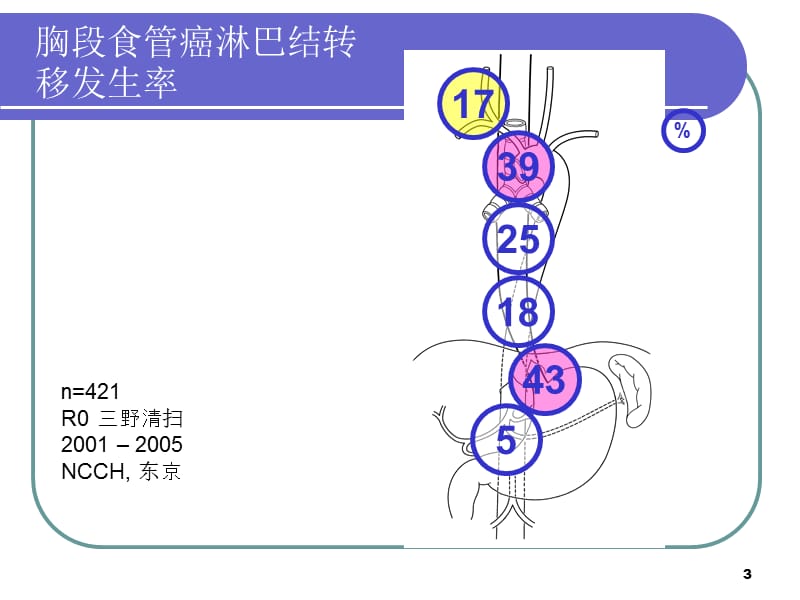 胸腹腔镜下食管癌切除术中胃的游离及胃周淋巴结清扫技巧ppt课件_第3页