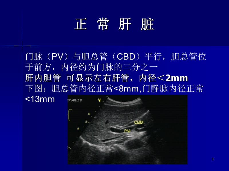 胸腹部超声培训ppt课件_第3页