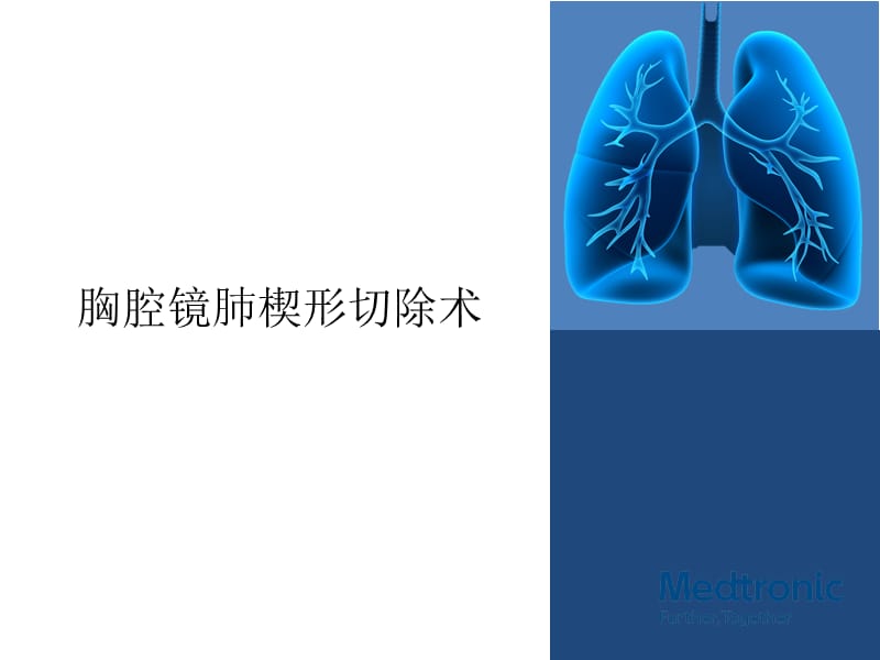 胸腔镜肺楔形切除术ppt课件_第1页