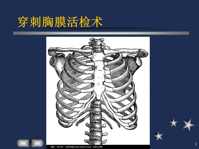 胸膜活检术ppt课件_第1页