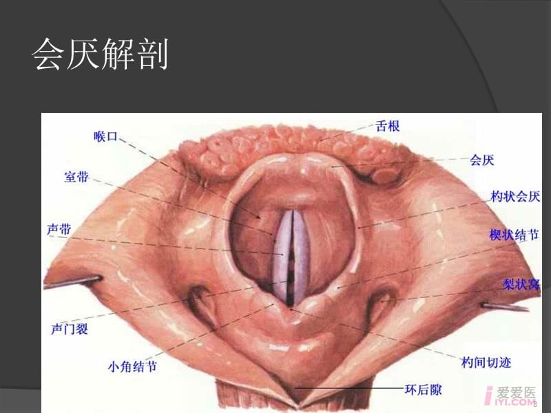 新生儿会厌囊肿ppt课件_第3页