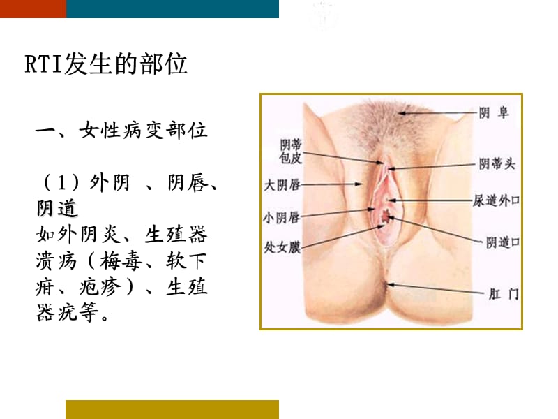 性传播感染和生殖道感染ppt课件_第3页