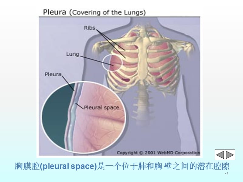 胸腔积液ppt课件_第3页