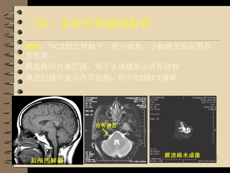 眩晕诊治新进展ppt课件_第2页