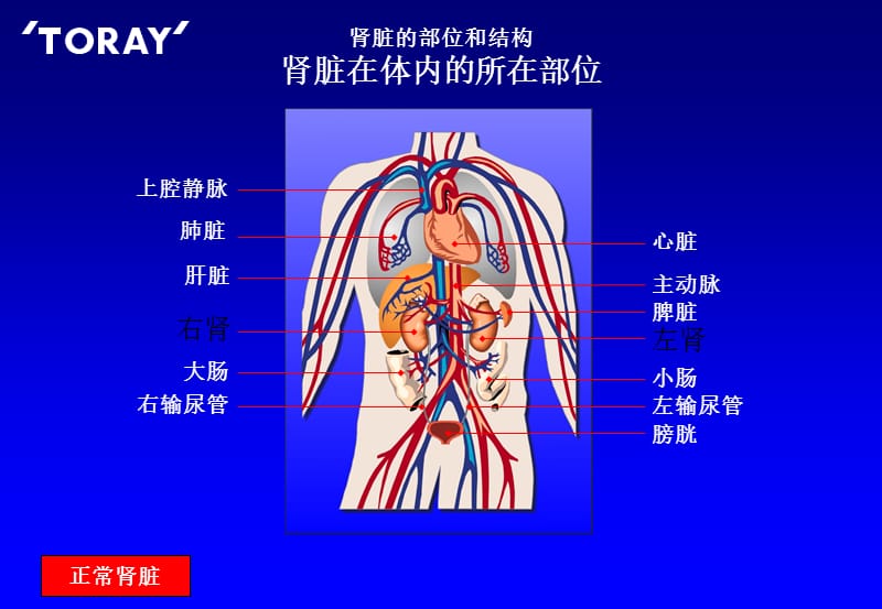 血液透析原理ppt课件_第3页