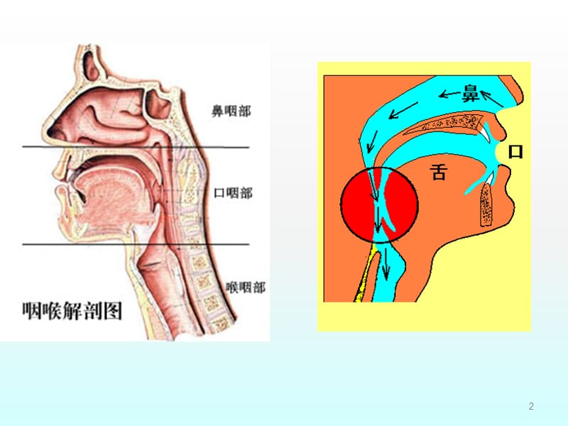 咽炎病人的护理ppt课件_第2页