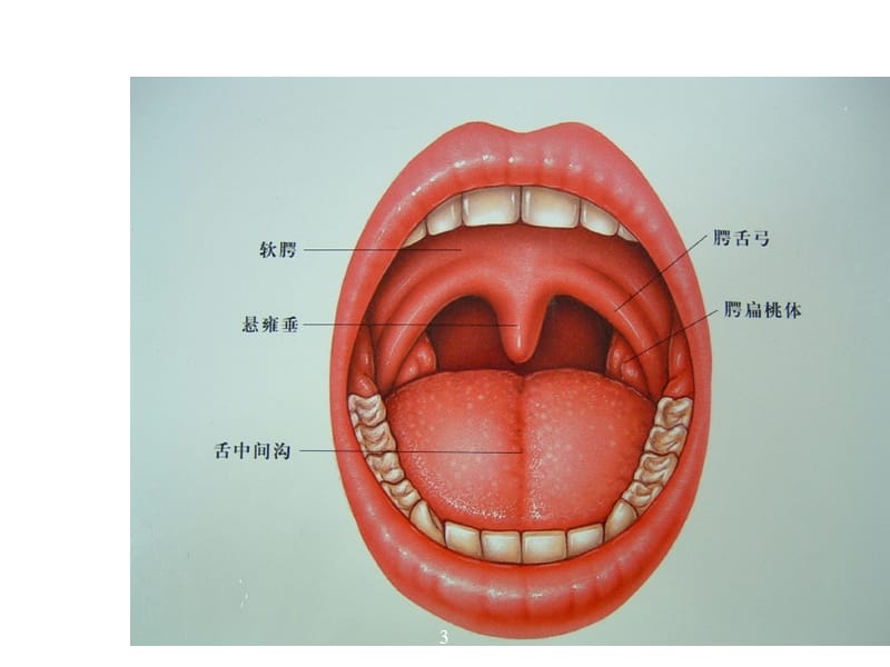 咽炎慢性扁桃体炎腺样体炎ppt课件_第3页