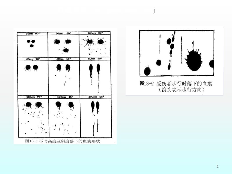 血液系统疾病ppt课件_第2页