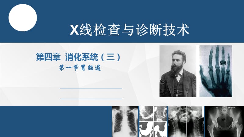 医学影像诊断基础第四章消化系统ppt课件_第1页