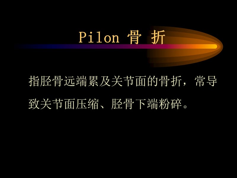 Pilon骨折外固定架固定技术探讨.ppt_第2页