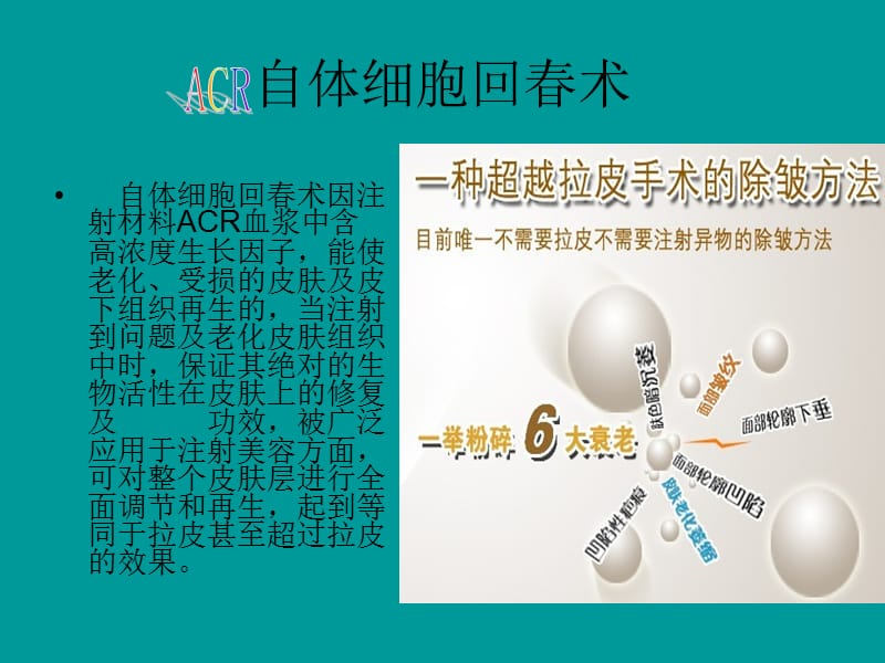 ACR自体细胞回春术.ppt_第2页