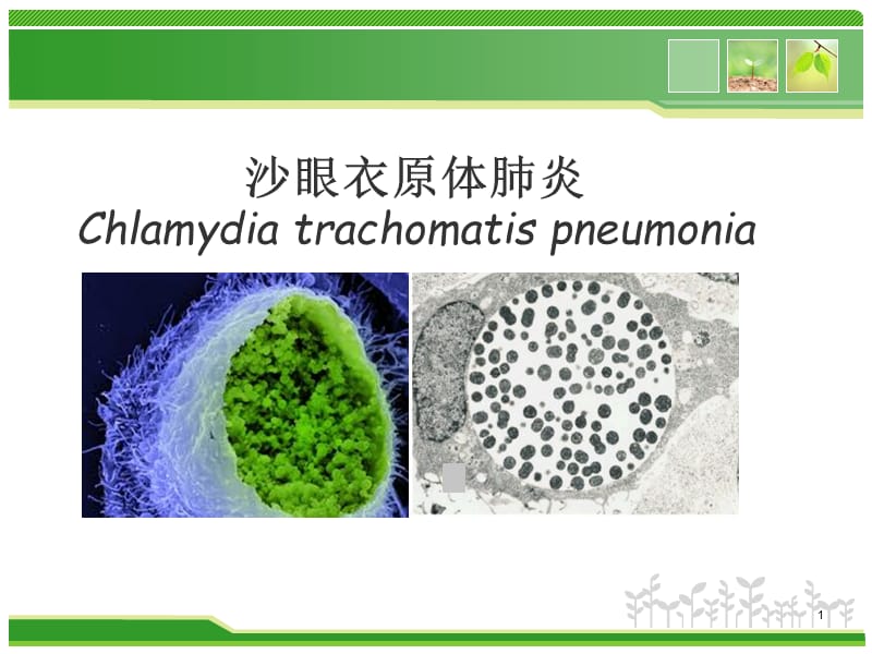 婴儿沙眼衣原体肺炎ppt课件_第1页