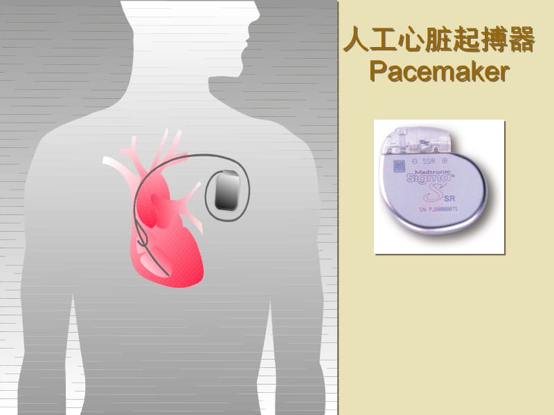 2013永久性心脏起搏器临床应用.ppt_第2页