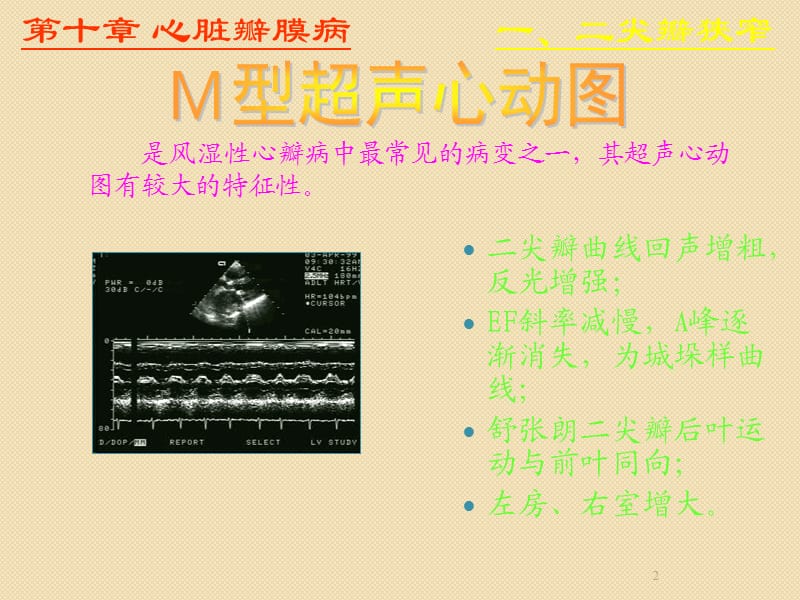 异常超声心动图ppt课件_第2页