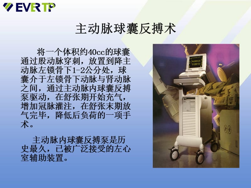 DatascopeIABP临床护理.ppt_第2页