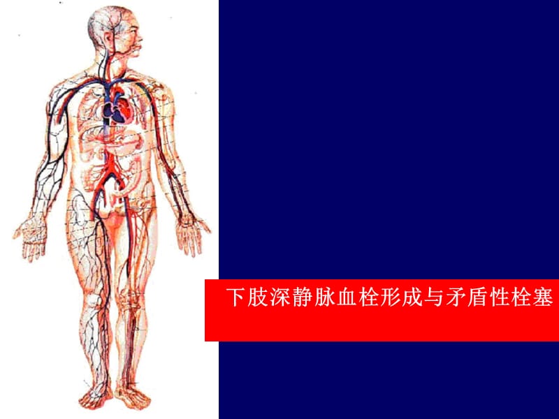 《下肢静脉血栓》PPT课件.ppt_第2页