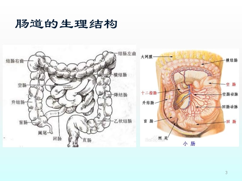 粘连性肠梗阻肠梗阻导管ppt课件_第3页