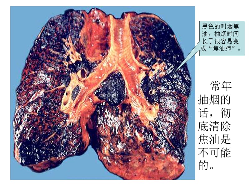 初中生健康教育-吸烟有害健康.ppt_第3页