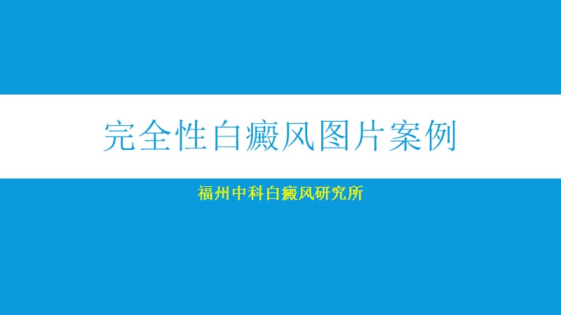 完全性白癜风图片案例.ppt_第1页