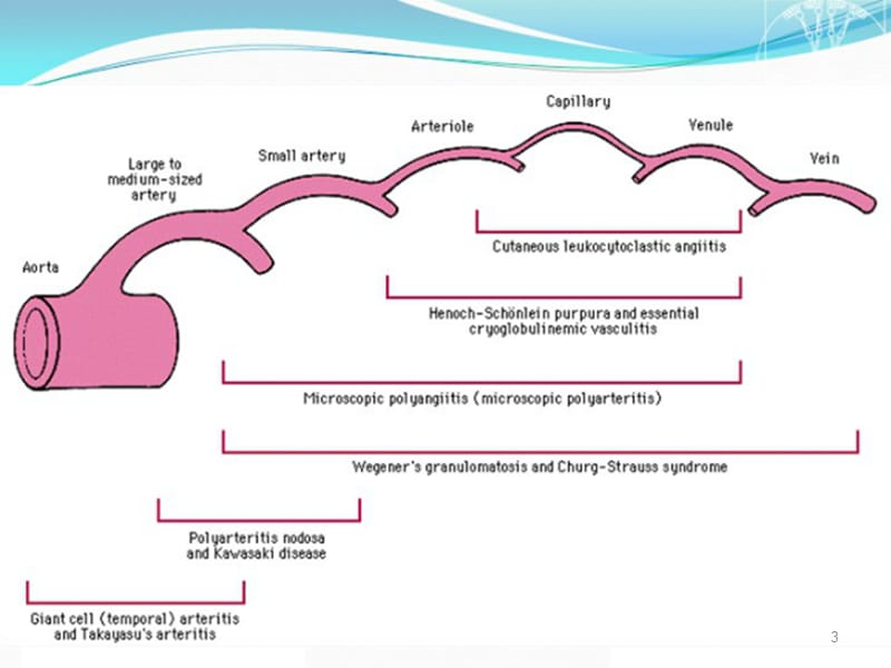 系统性血管炎诊断思路ppt课件_第3页