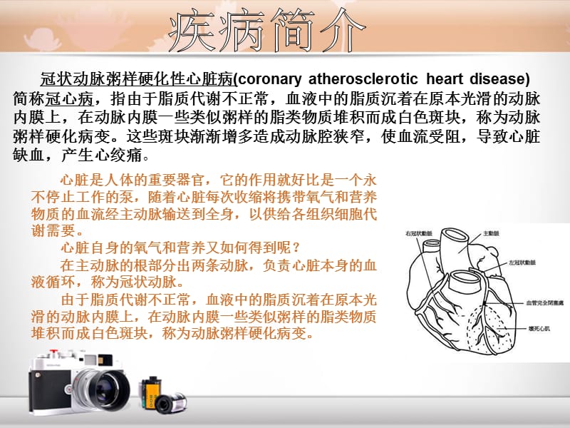 《演讲人-冠心病》PPT课件.ppt_第3页