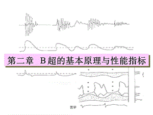 B超的基本原理與性能指標(biāo)課件.ppt