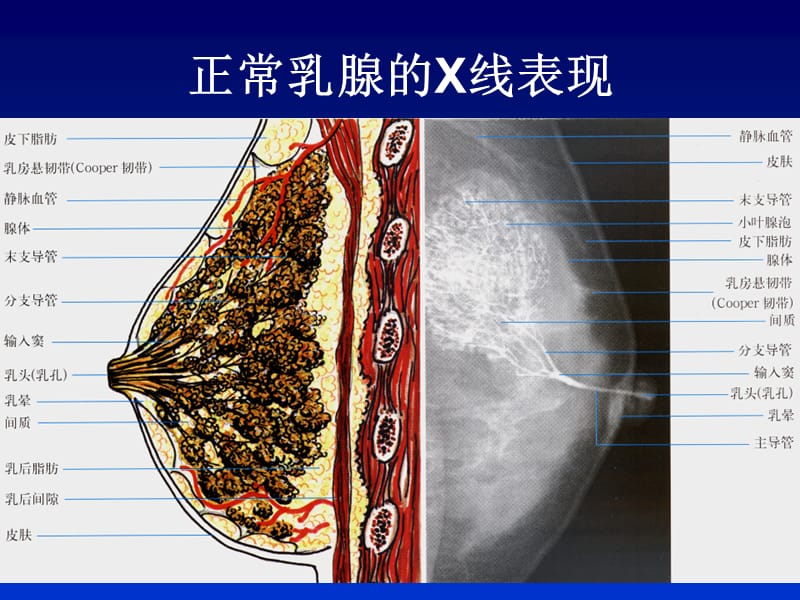 全数字化乳腺机的临床应用.ppt_第2页