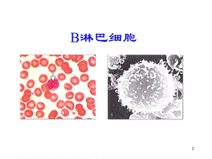 B淋巴细胞的发育分化ppt课件