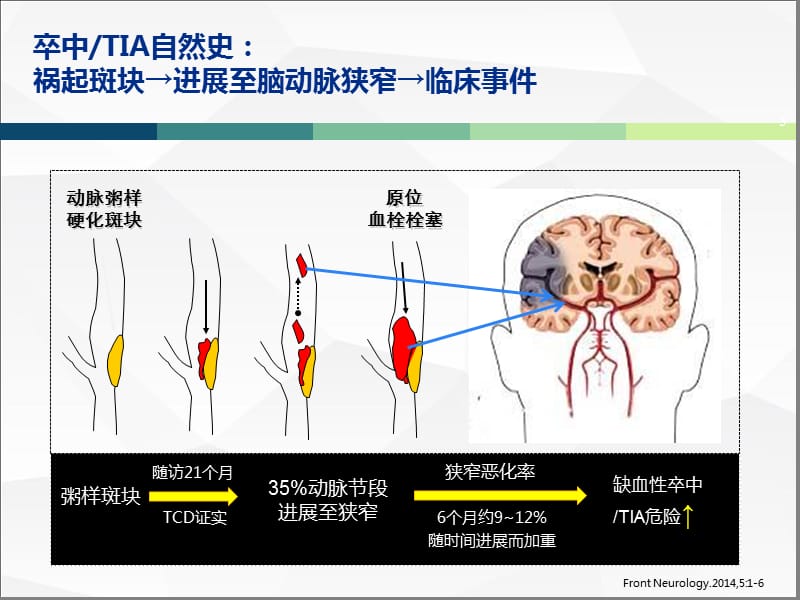 动脉粥样硬化斑块与心脑血管的新观点ppt课件_第3页