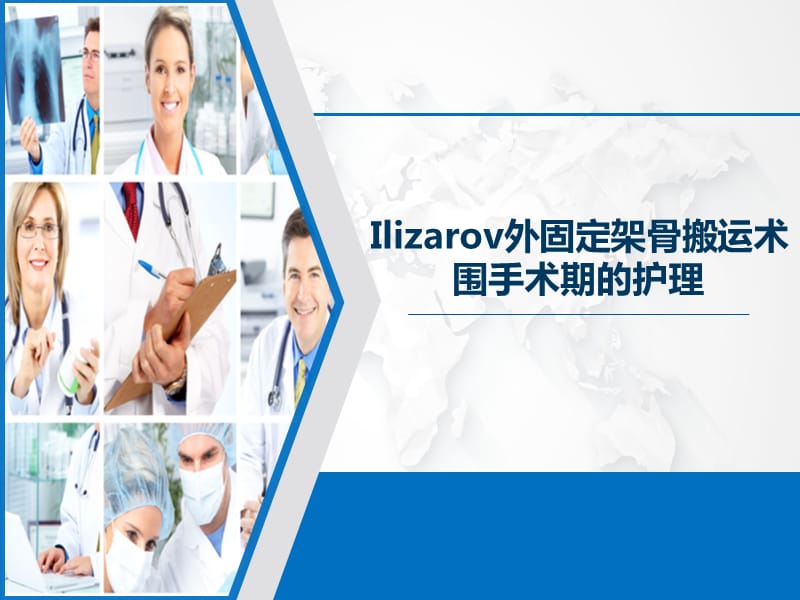 Ilizarov外固定架骨搬运术围手术期的护理.ppt_第1页