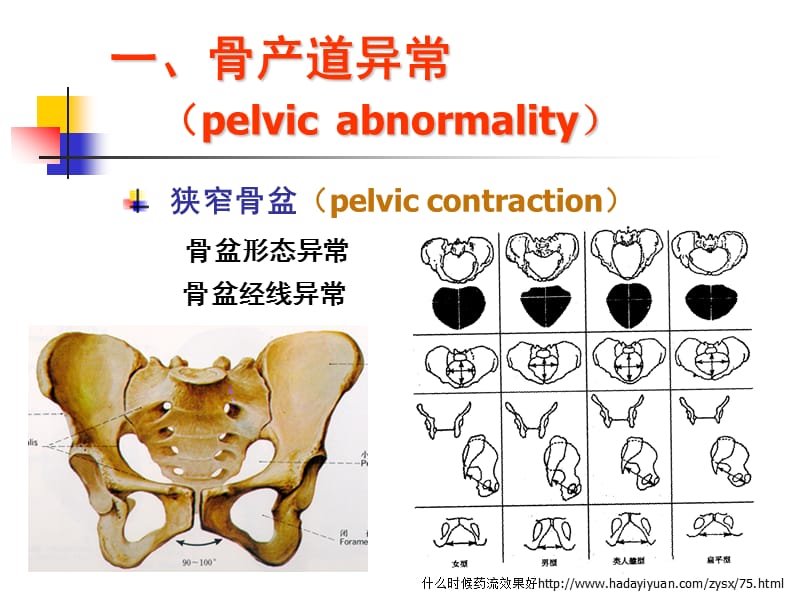 产道异常的分类和临床表现.ppt_第3页