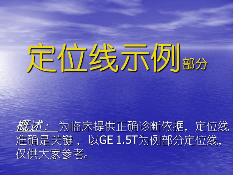 MRI扫描部分定位线.ppt_第1页