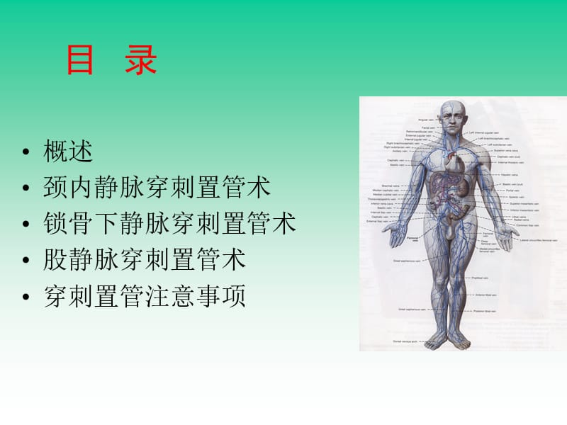 中心静脉穿刺置管术.ppt_第2页