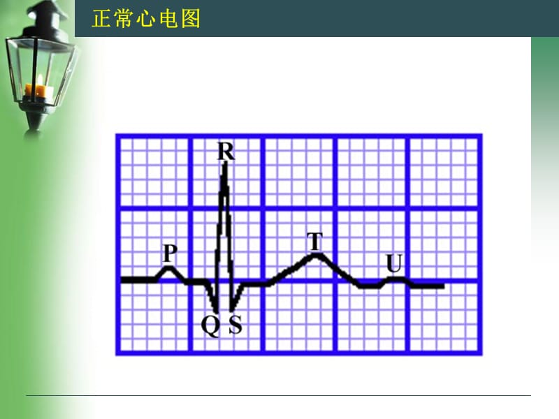 ST-T改变的分类与临床意义.ppt_第2页