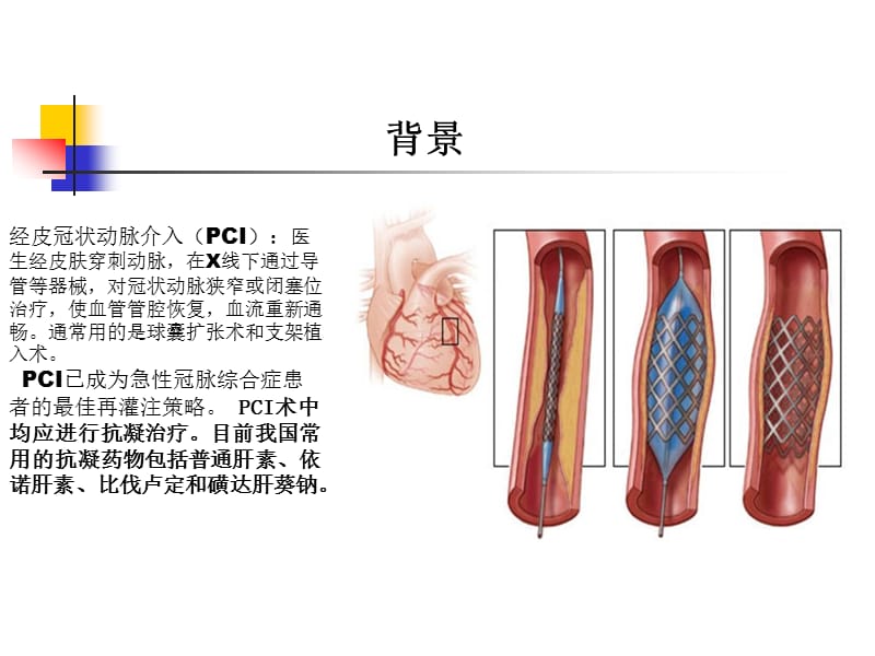 PCI围术期抗凝治疗中比伐卢定与肝素的比较.ppt_第3页