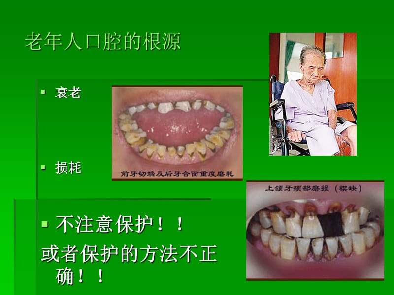 中老年人的口腔卫生保健.ppt_第3页