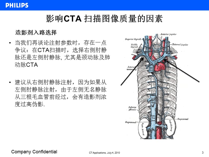 Philips-CT-CTA扫描技术.ppt_第3页